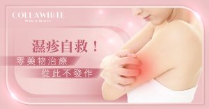 濕疹成因與舒緩